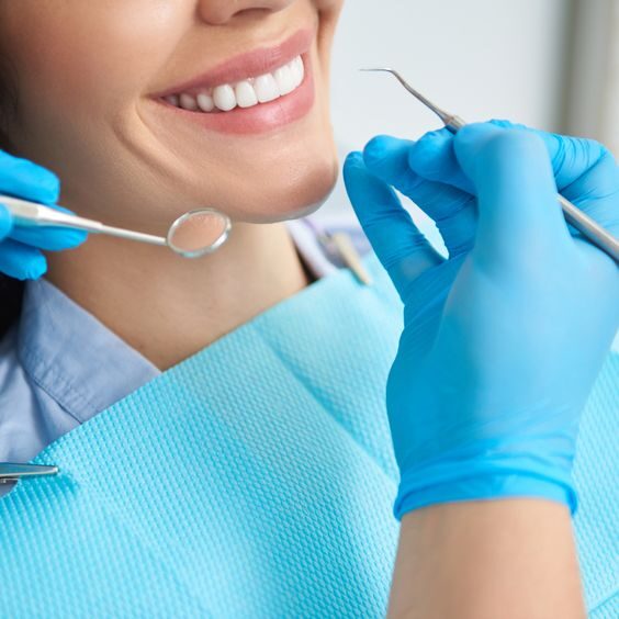 Veneers (Hollywood Smile)